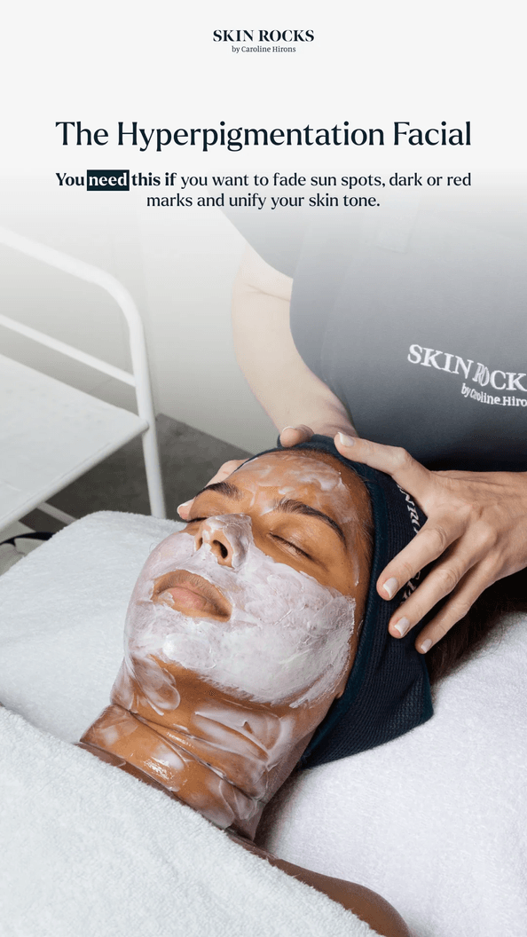The Hyper Pigmentation Facial