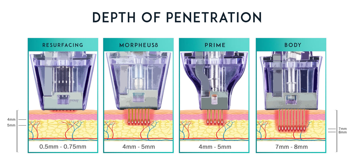 Diagram showing the depth of penetration for a cosmetic device with labeled stages.