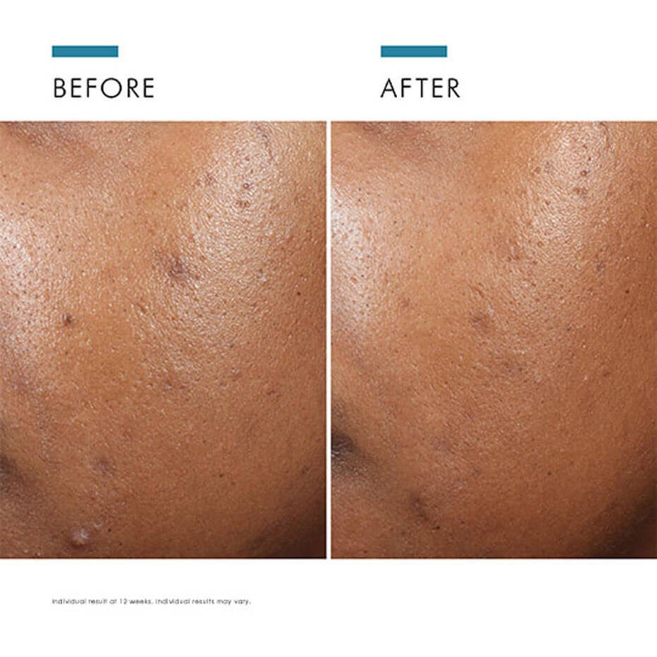 SkinCeuticals Phyto A+ Brightening Treatment